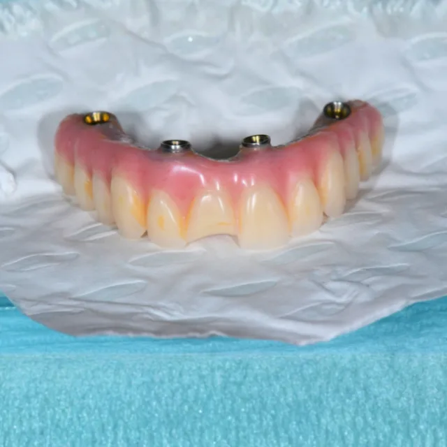 Common Dental Emergencies We Assess