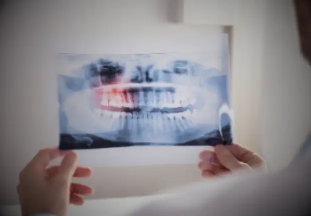 What to Expect & Supporting Your Smile