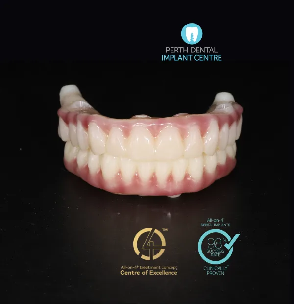 All-on-4 dental implants in Applecross