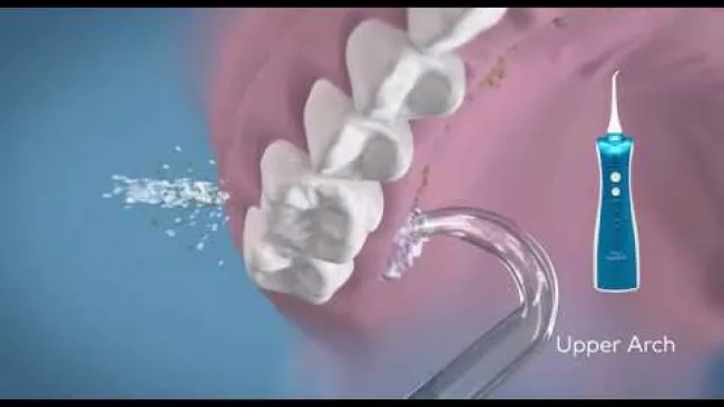 All-on-4® Dental Implants